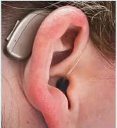 Receiver-in-the-ear (RITE) worn on ear